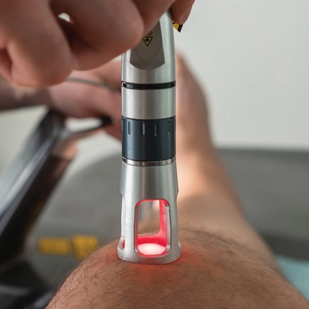 Laser therapy being performed on a patients knee.